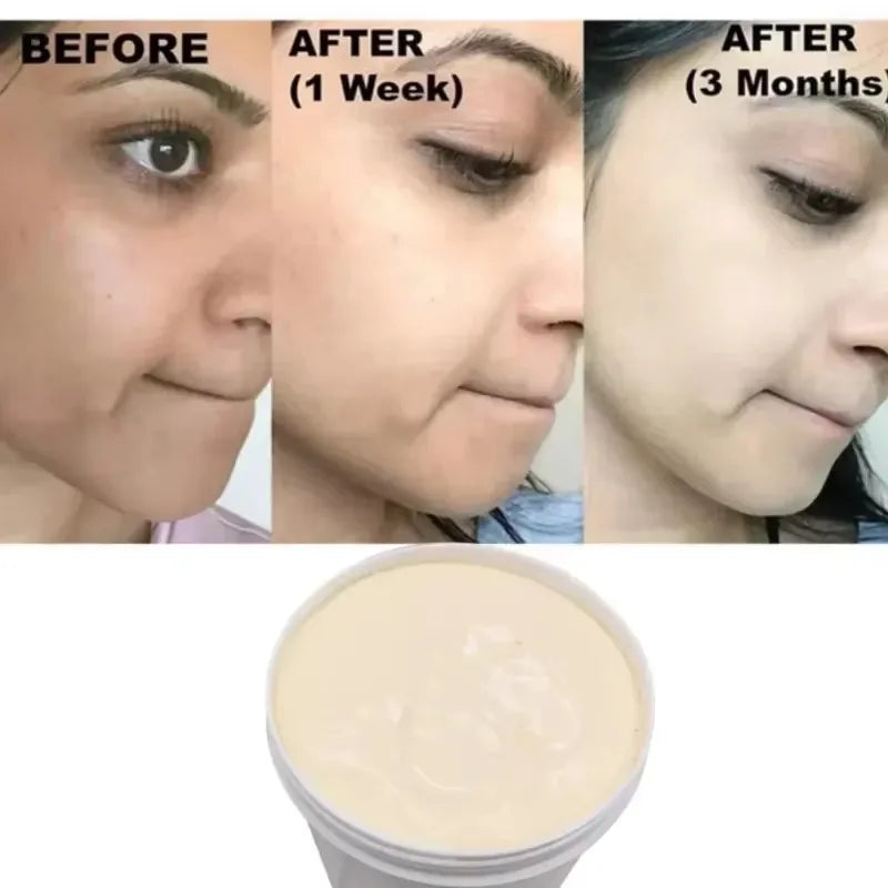Dark Skin Brightening Cream is a powerful, high-quality product for face, neck, hands and feet with no side effects